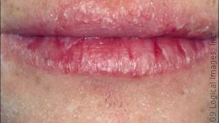 BUTTER BALM